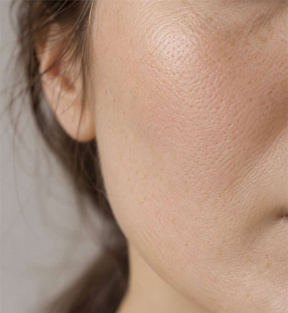 Vidéo : Injections de skinbooster